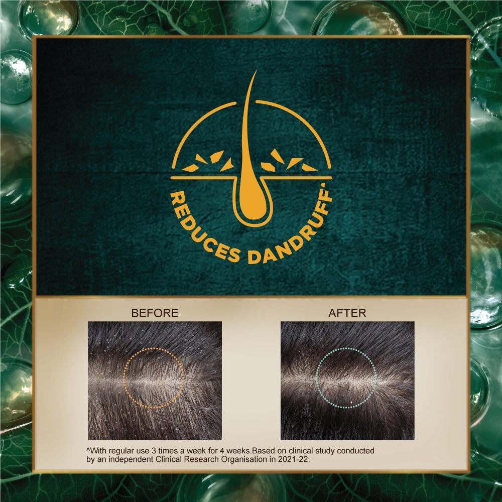 Dandruff Treatment Shampoo 580ml