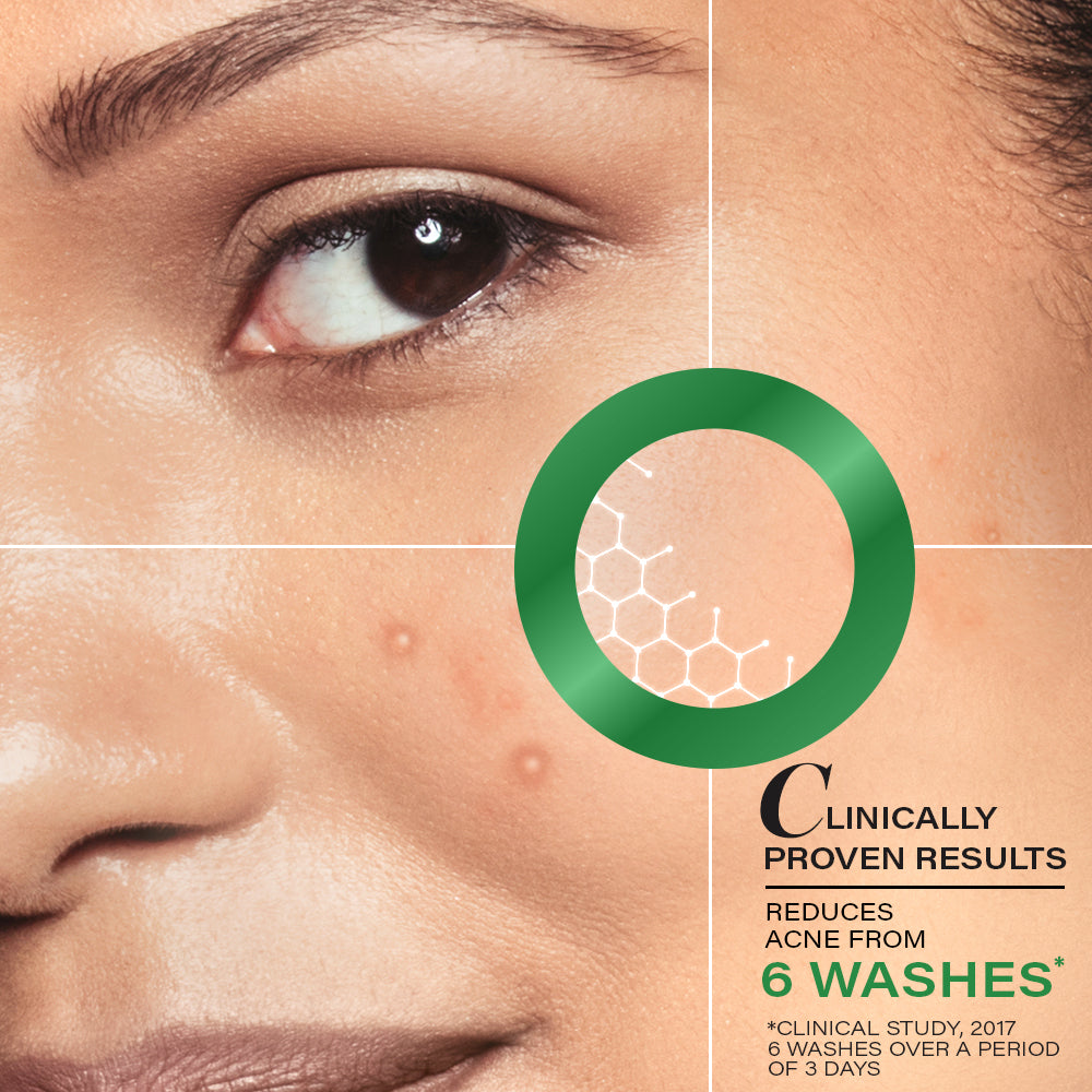 Novology Acne Deep Clearing Cleanser