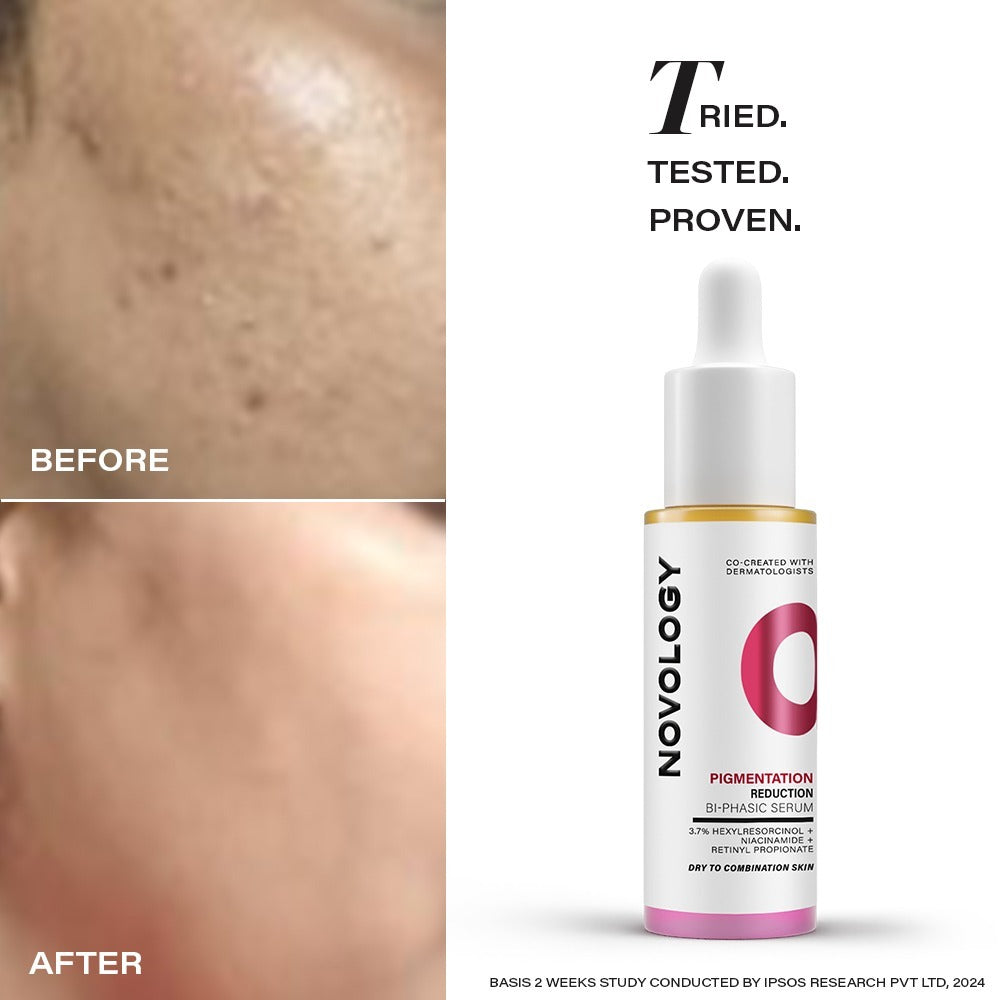 Pigmentation Reduction Bi-Phasic Serum